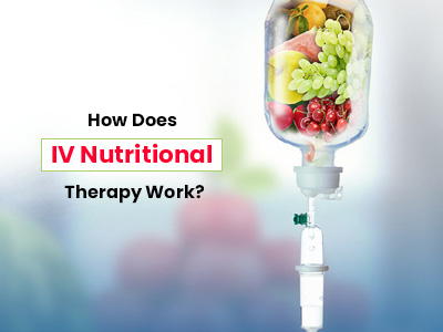 IV nutritional therapy _ Gonewcreation